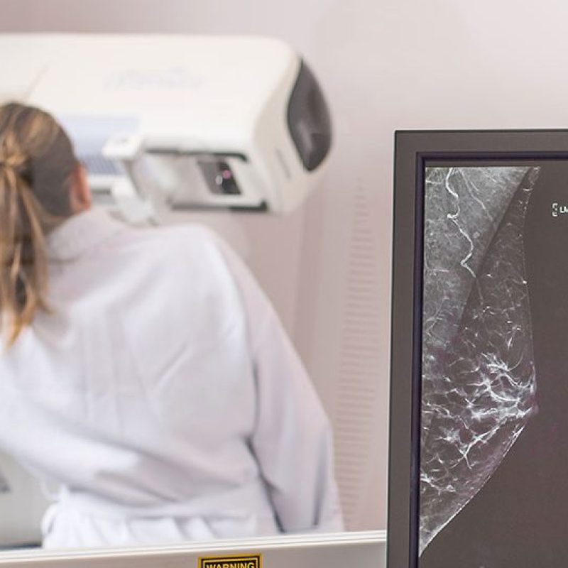 bg-noosa-radiology-breast-imaging